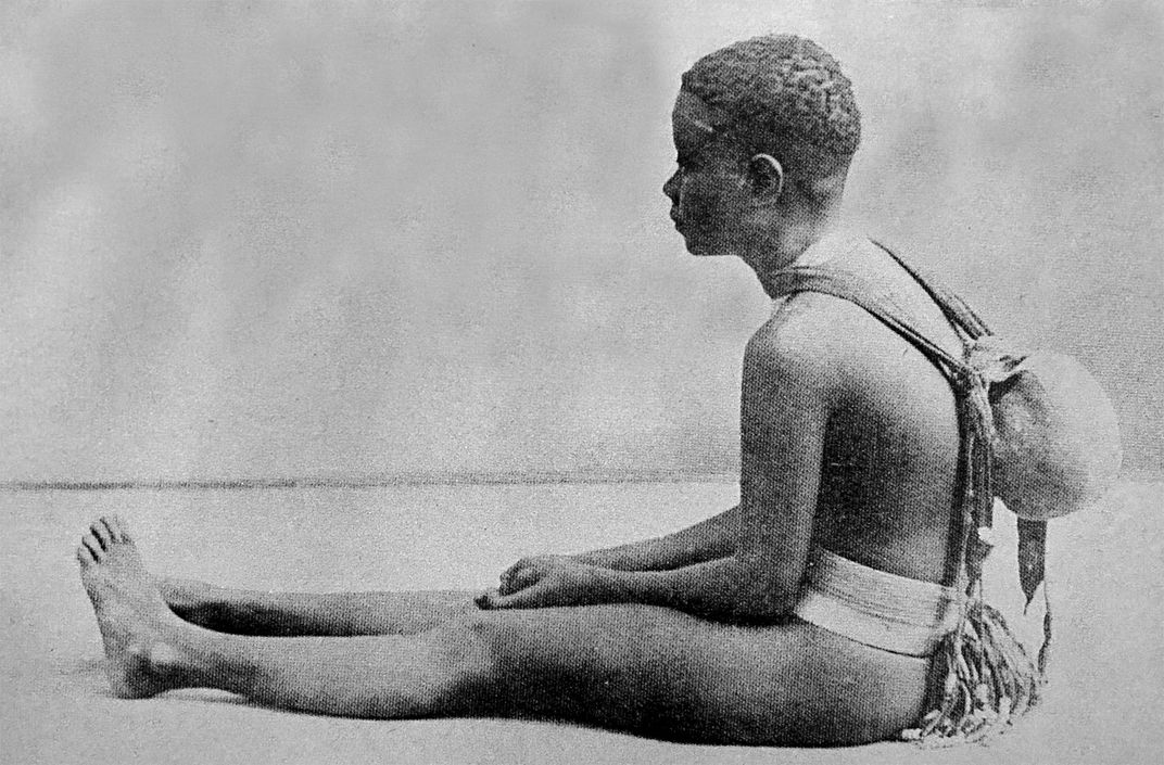 A circa 1908 photo of an Andaman girl wearing her sister's skull