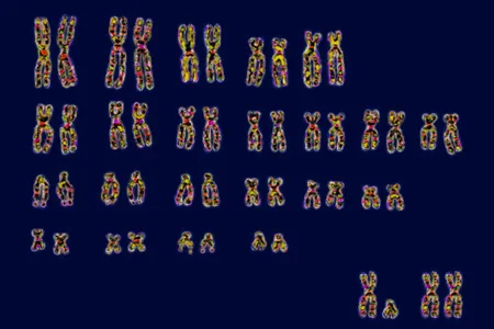 The 23 pairs of human chromosomes. People who inherit two tall X chromosomes (bottom right) are much more susceptible to autoimmune diseases than people with one X and one short Y chromosome.