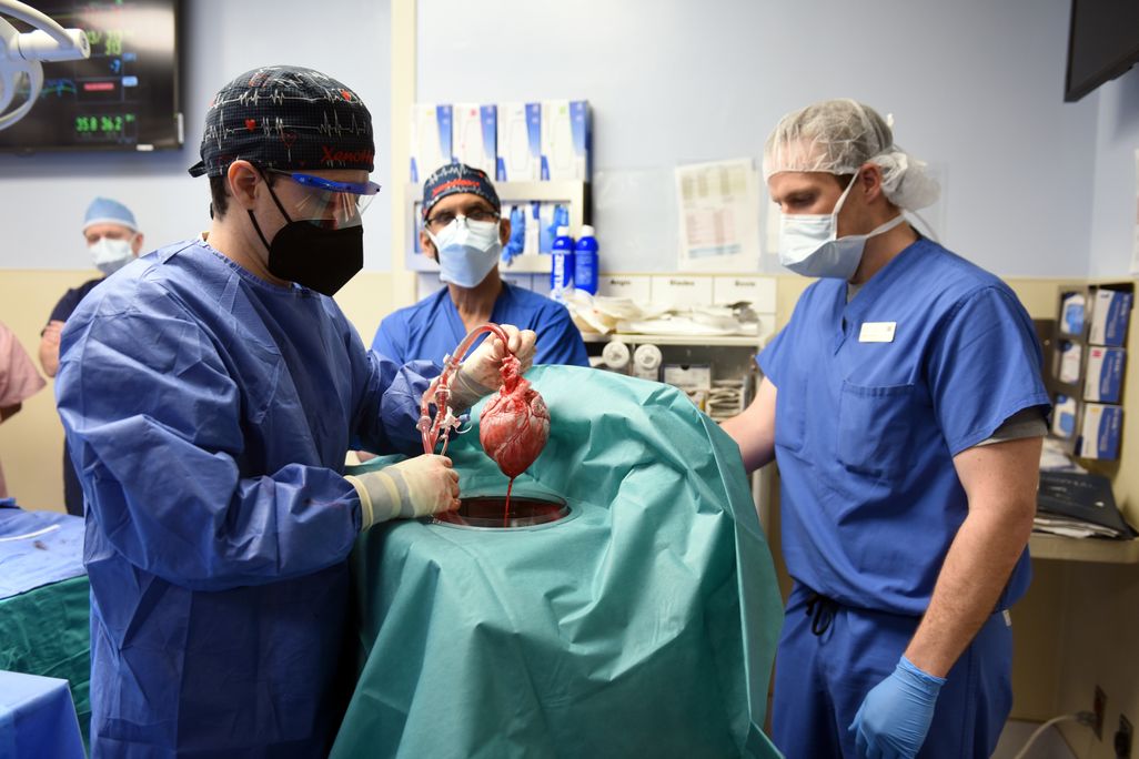 A group of doctors in an operating room, one doctor holding a pig heart