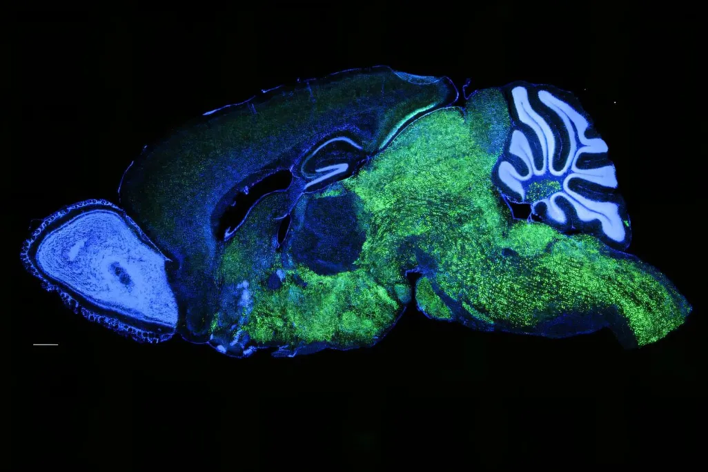 Expression pattern of NOVA1 in the brain of a mouse. NOVA1 in green, nuclei (DAPI) in blue.