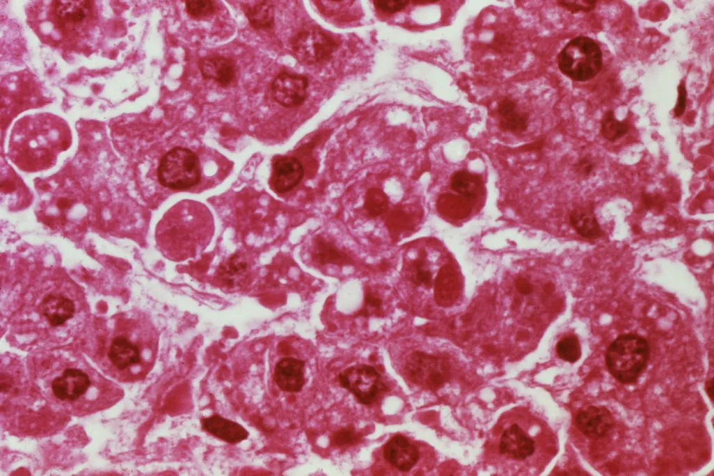 11_13_2014_ebola.jpg