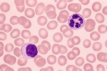 Two types of white blood cells, a neutrophil (top) and a lymphocyte (bottom), in human blood.