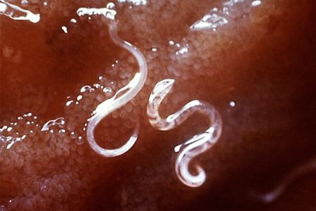 Evidence (some anecdotal and some clinical) suggests that hookworms could suppress the immune response in people with allergies and other inflammatory diseases. 