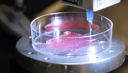 Can Printed 'Skin' Heal Burns and Prevent Scars?