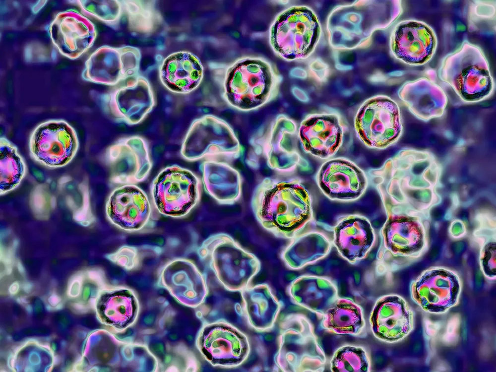 Measles virus seen through a microscope