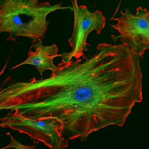 Endothelial cells under the microscope