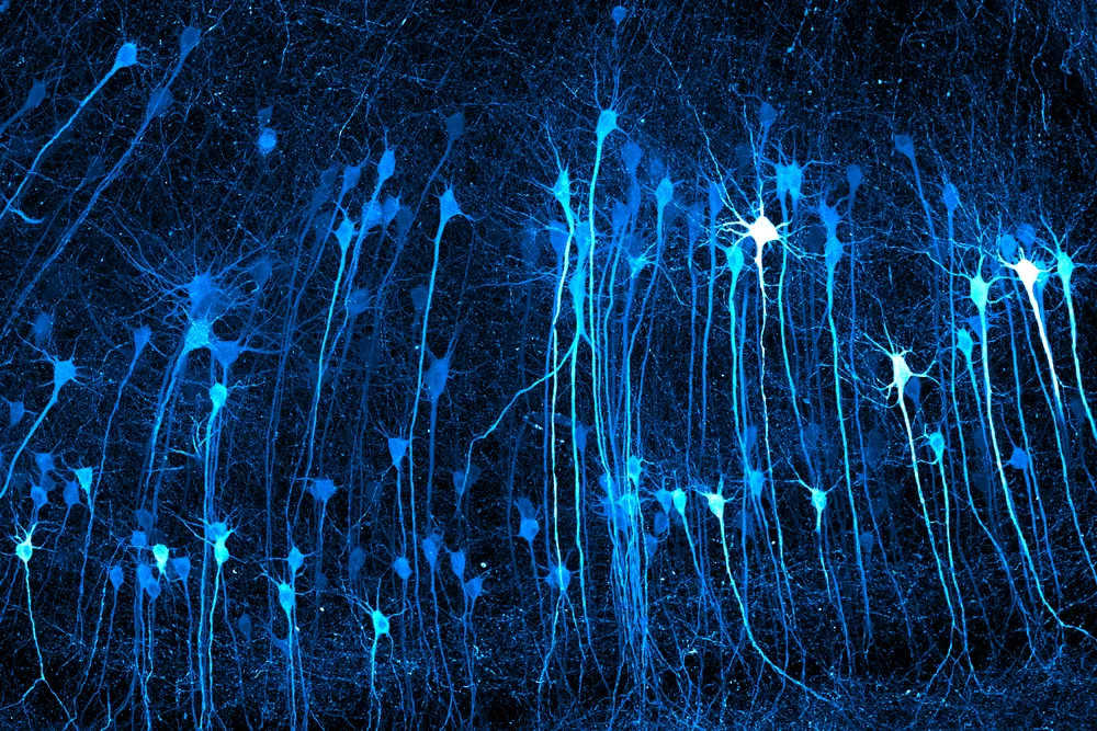 Neurons in mouse brain