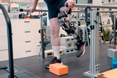 A patient with the new prosthesis walks over an obstacle.&nbsp;