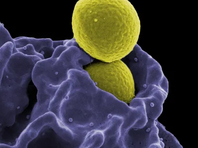 A new type of antibiotic is effective against antibiotic-resistant bacteria like Methicillin-Resistant Staphylococcus aureus (MRSA).