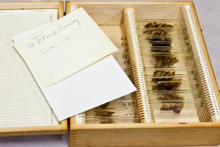 Currently, the only place the public can see Einstein's brain on display is at the Mütter Museum in Philadelphia. 