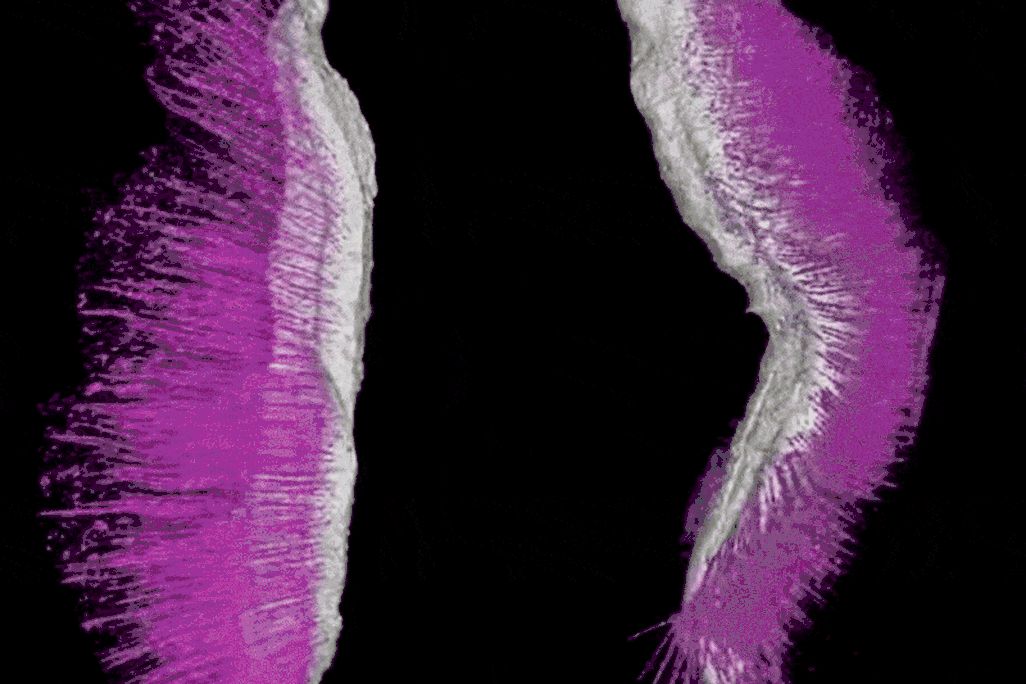 gif of two spiky-looking worms
