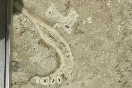 An anonymous dentist recognized the jawbone, because it looked similar to the CT scans he reviews every day at work.