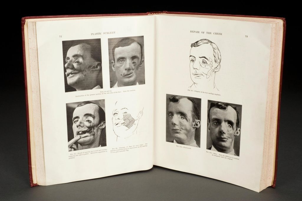 Pages from Plastic Surgery of the Face by Harold Gillies