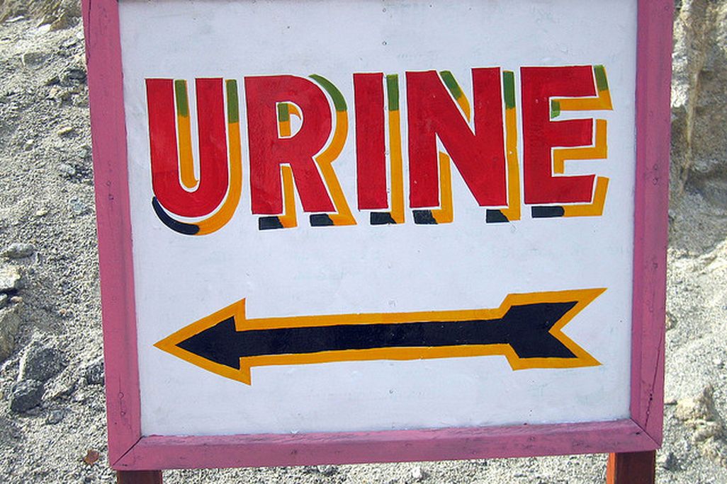 2013110810002811_08_2013_urine.jpg