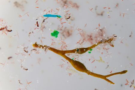 Microplastics mixed in with plankton from an Arctic Ocean sample