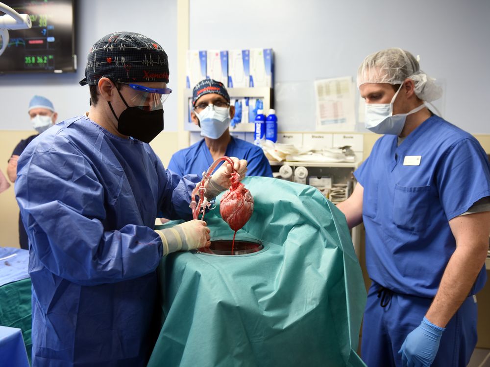 A group of doctors in an operating room, one doctor holding a pig heart