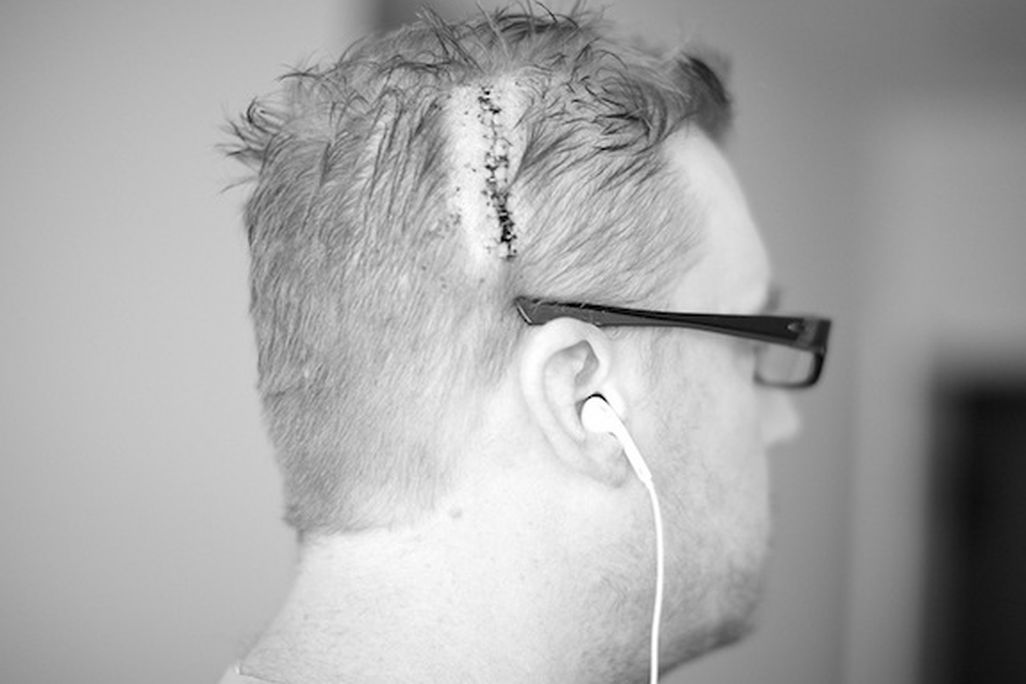 brain surgery