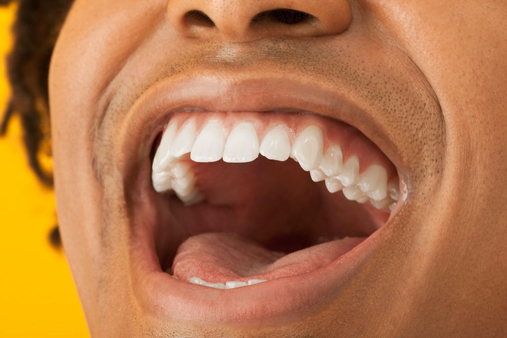 laughter