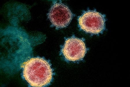 &nbsp;Researchers speculate that type two inflammation that occurs in allergic conditions may reduce levels of the ACE2 receptor on the surface of airway cells, where SARS-CoV-2&rsquo;s spike protein binds to. (Pictured: Novel Coronavirus SARS-CoV-2 under and electron microscope)