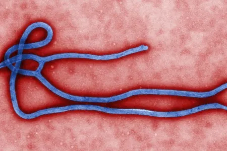 A colorized microscopic image of a viral particle of the Ebola virus. The virus, which scientists believe originates in non-human primates, causes Ebola hemorrhagic fever, a deadly disease in humans, monkeys, gorillas and chimpanzees.