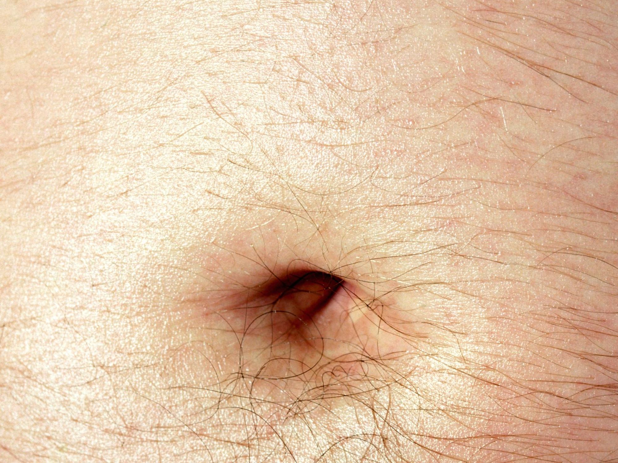here-s-why-some-people-have-more-bellybutton-lint-than-others