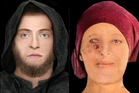 The high-status 16th-century woman (right) appears to have suffered from leprosy, a disfiguring disease that likely left its mark on her skin, tissues and bone.