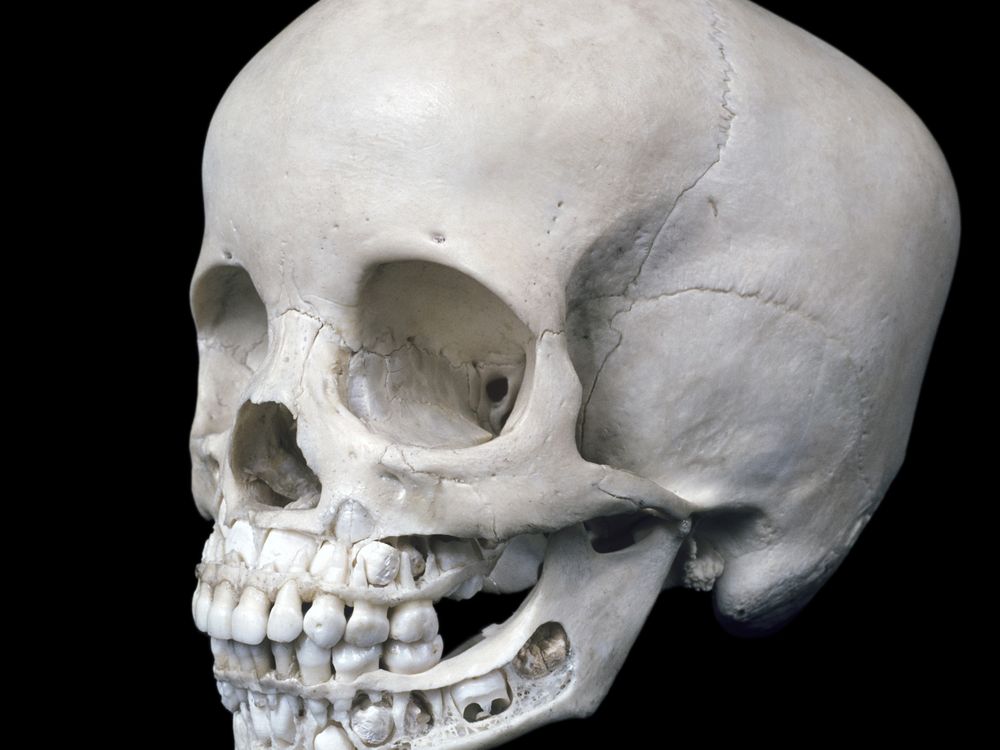 skull