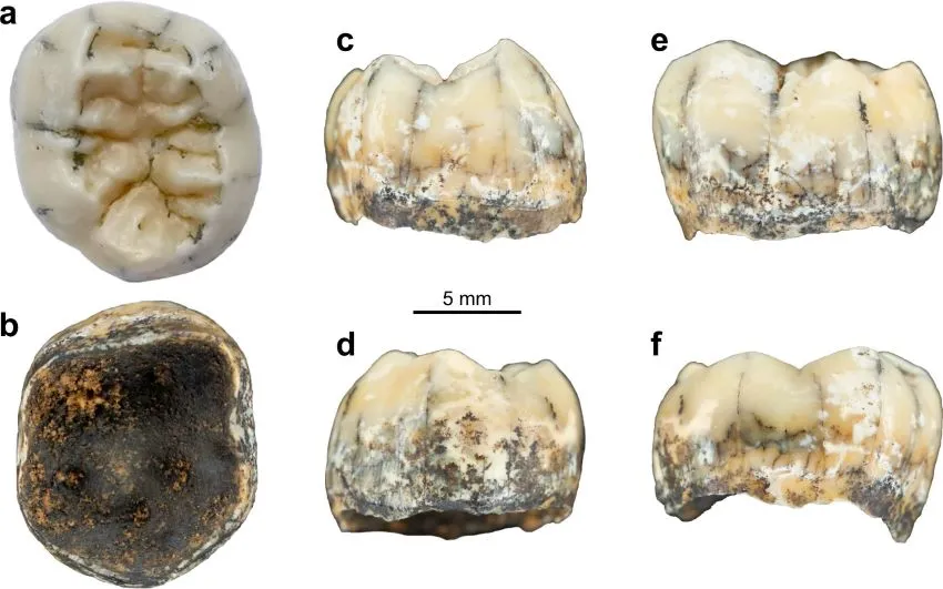 Six images of a tooth from different angles