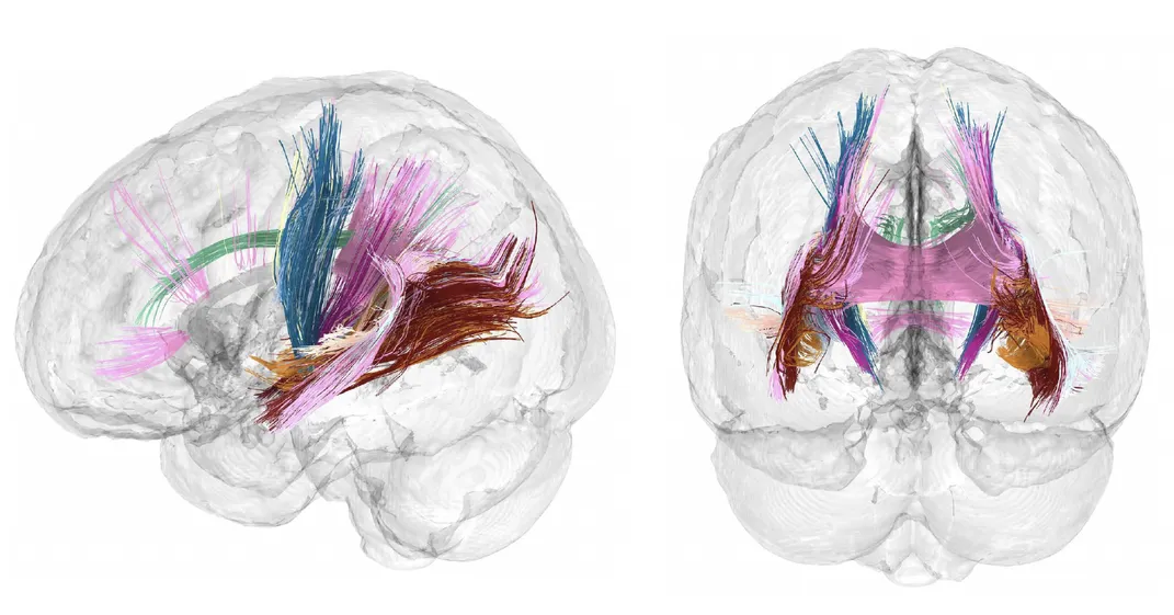 two diagrams of the brain showing brightly colored filaments deep in the organ