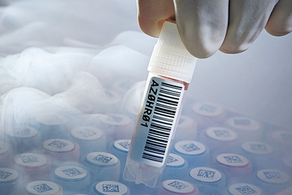 Nitrogen-cooled tissue samples