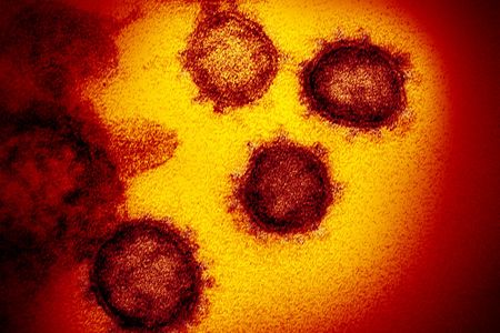&nbsp;SARS-CoV-2, the virus that causes Covid-19, under the microscope