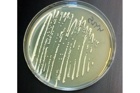 Yeast, a multipurpose microbe.