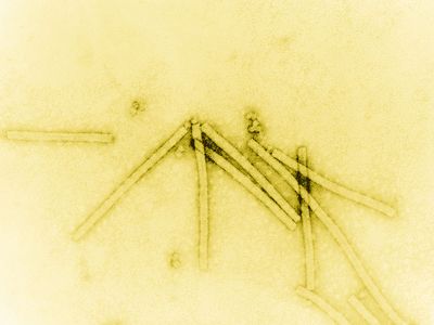 The tobacco mosaic virus seen under 160,000× magnification