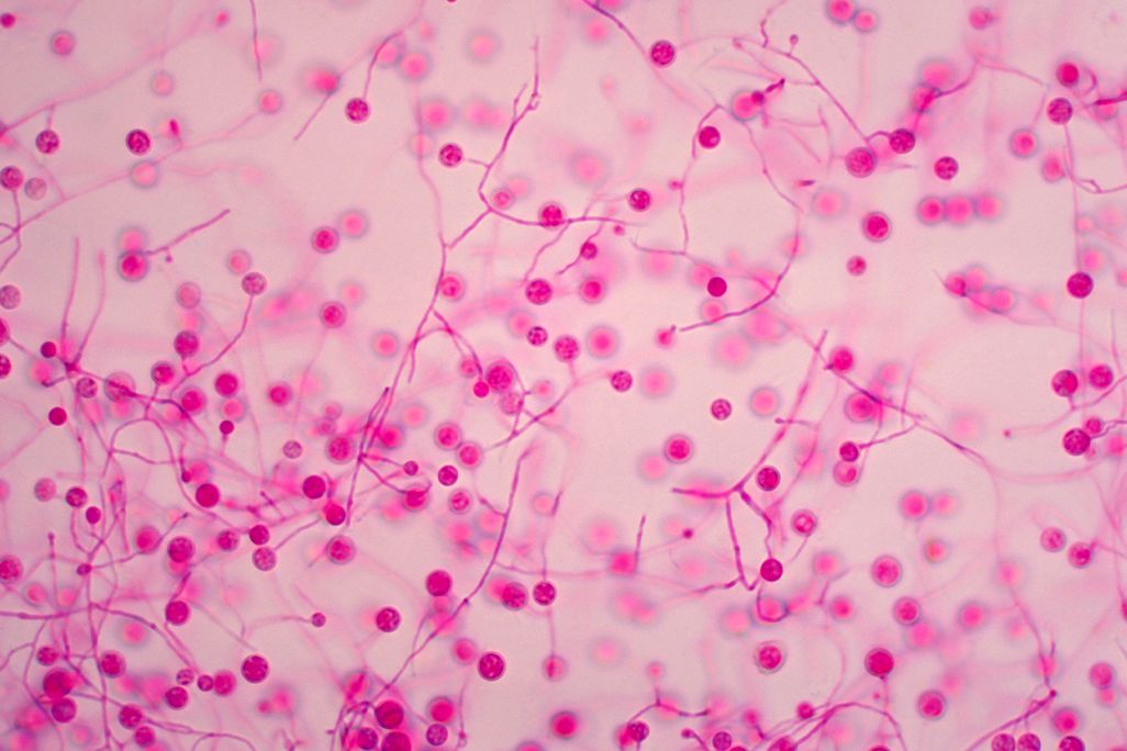 Histoplasma
