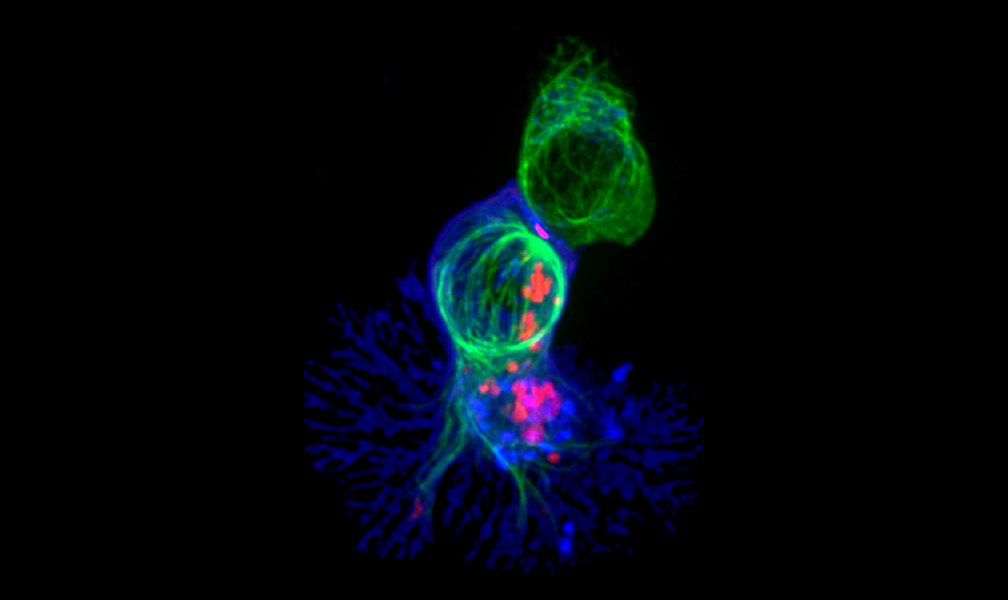 Why Immunity to the Novel Coronavirus Is So Complicated