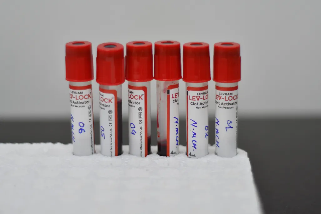 Blood samples in tubes
