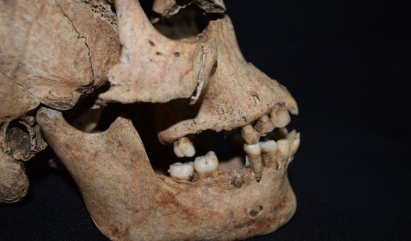 Cranium of an individual recovered from beneath the Cathedral of Panama Viejo. (Javier Rivera Sandoval, ArtEmpire)