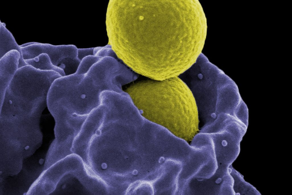 MRSA