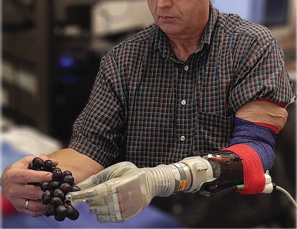 Robotic Hand Restores Sense Touch | Smart News| Magazine