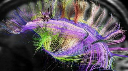 The brain is more grid than tangle of spaghetti.