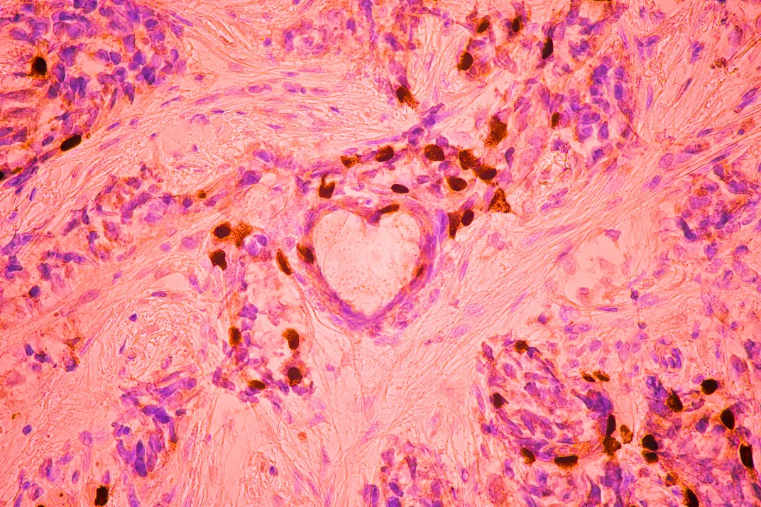 3 pink swirly cells in the shape of a heart