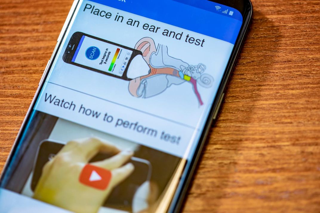 Researchers Develop App That Plays Chirping Sounds to Check for Ear Infections