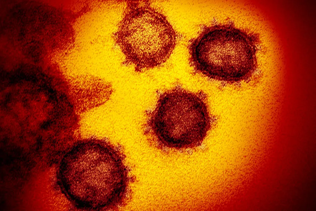 microscope image of  SARS-CoV-2