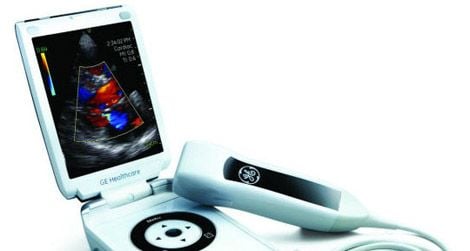 Reverse innovation in action: An ultrasound scanner shrinks to smartphone size.