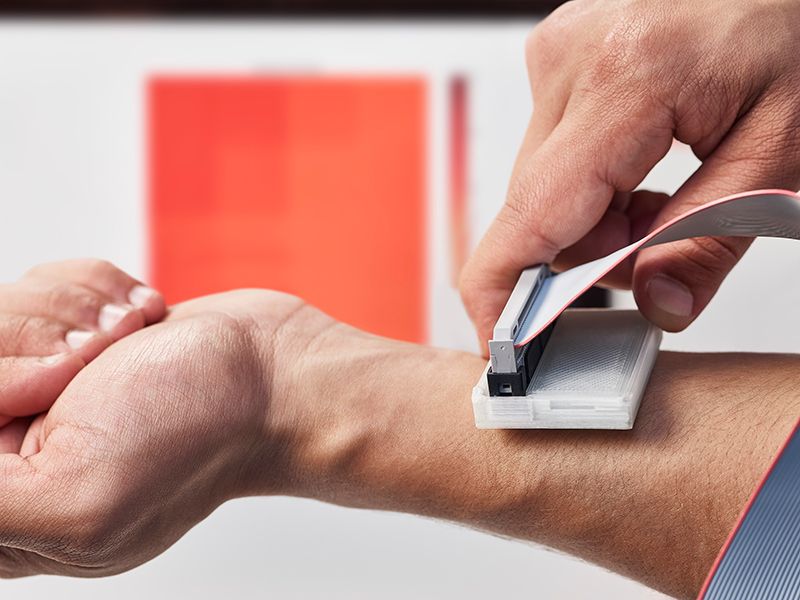 This Inexpensive Scanning Device Could Catch Skin Cancer Early