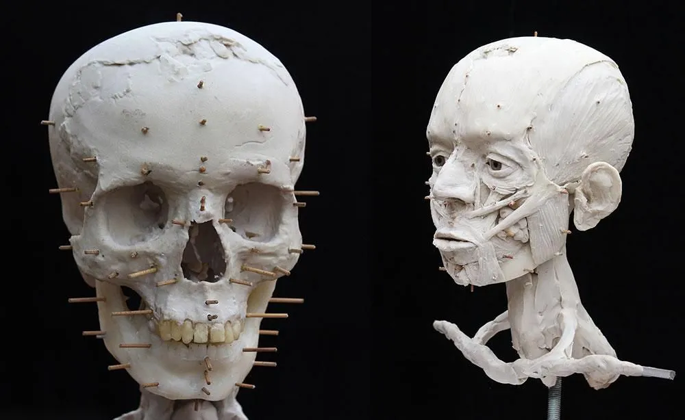 The 3D-printed skull used to start the 2016 facial reconstruction (left) and an early stage in the reconstruction process— applying the muscles to the skull (right)