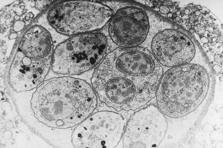 Toxoplasma gondii grows in tissue cysts which can stick around in the body after illness has passed 