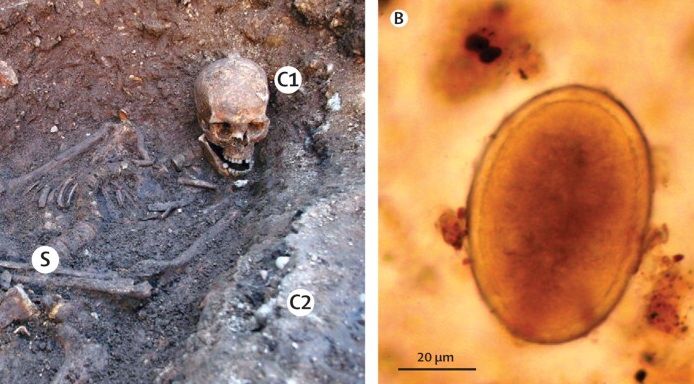 A sacral sample