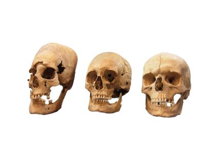 Strong, medium and undeformed skulls, from left to right in this image, were first found in Germany around the 1960s. Now researchers think they know where the modified skulls came from.