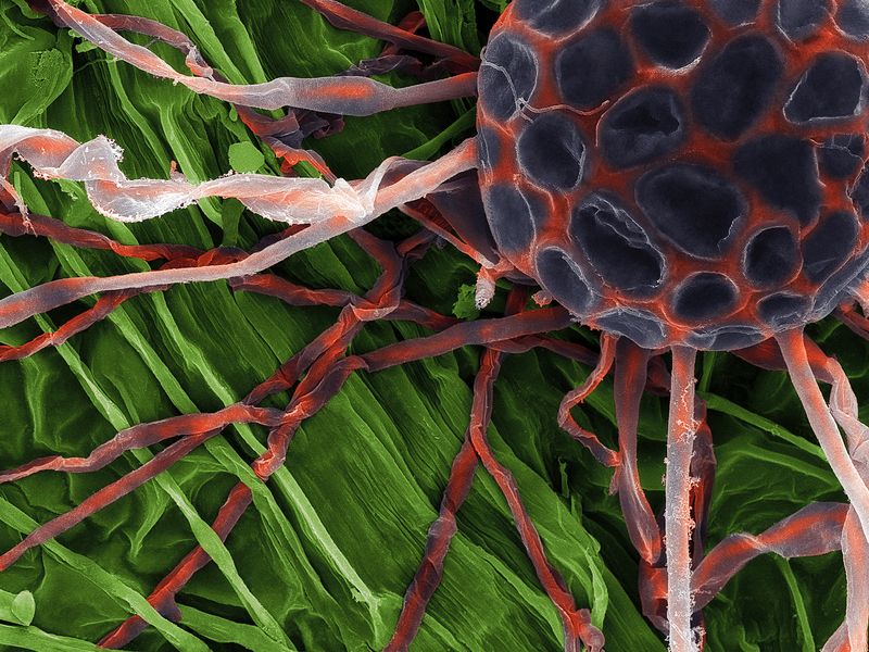 Photograph of Uncinula necator from scanning electron microscope